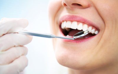 Účinek bělících činidel na zubní výplně